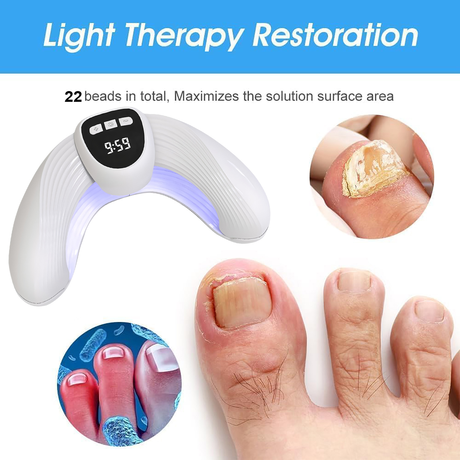 Laser Nail Fungus Treatment De - Industrial Laser Removal 리뷰 및 가격