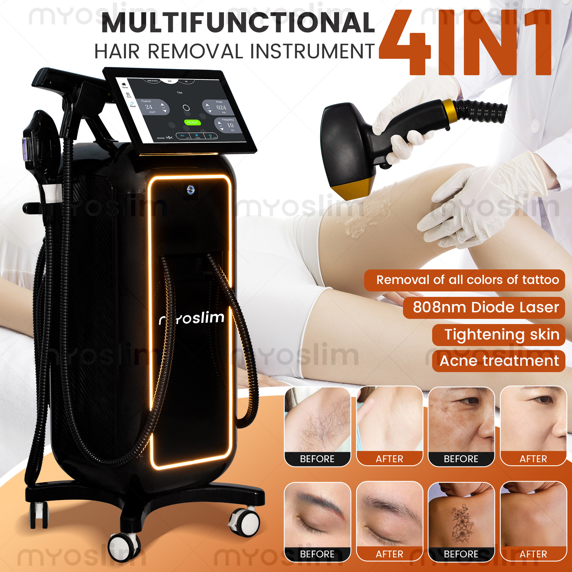 5000W Professional 4-in-1 Diod - Industrial Laser Cleaning Machine 리뷰 및 가격