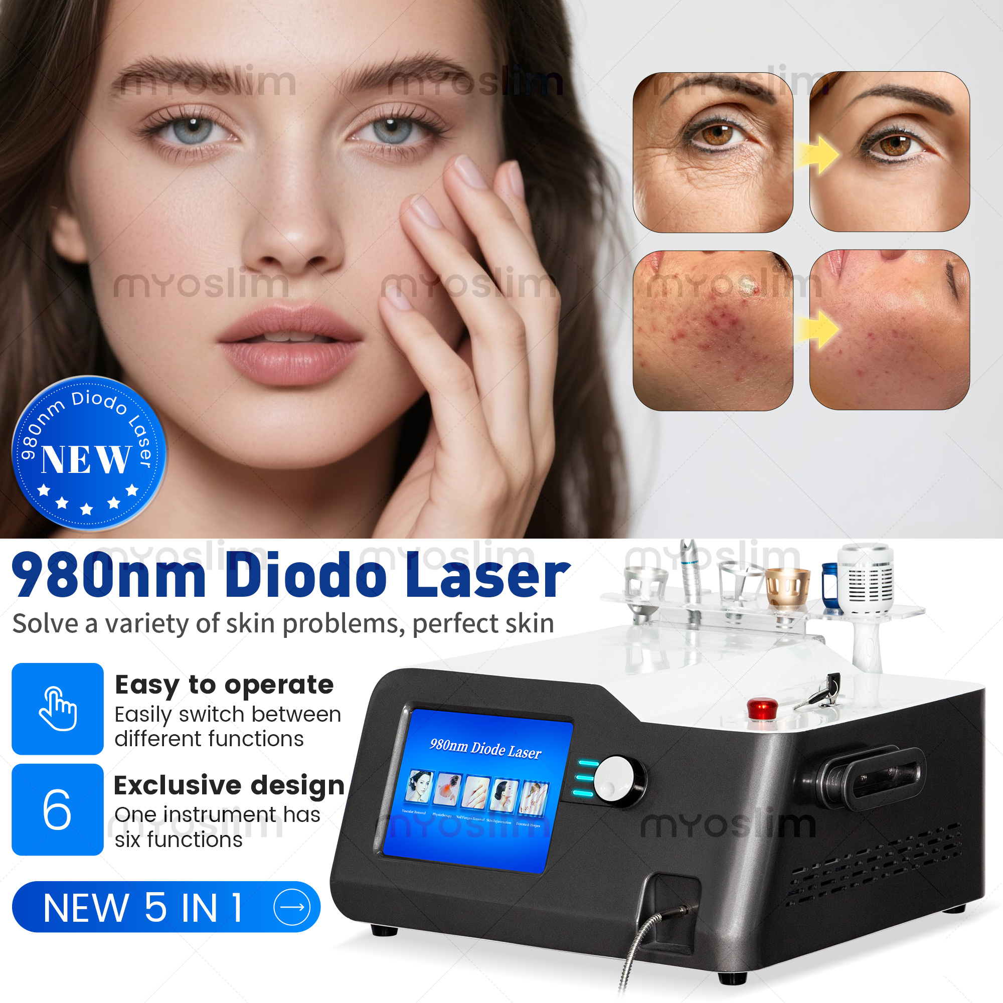 Portable 30W 5 in 1 980 nm Dio - Industrial Laser Cleaning Machine 리뷰 및 가격