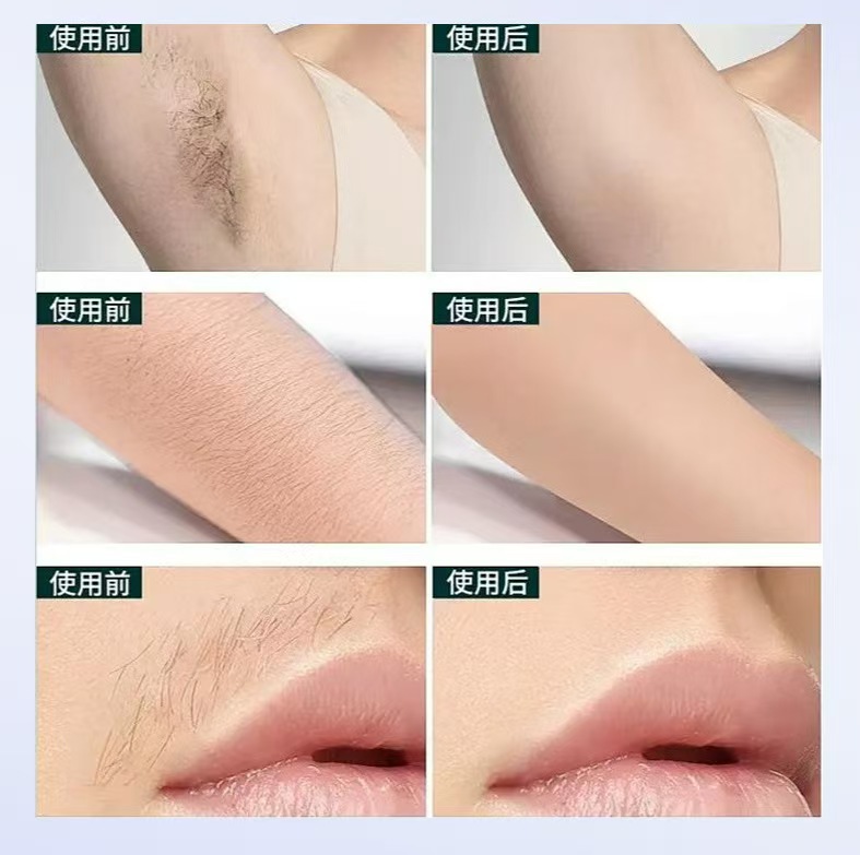 New Body Bikini IPL 500,000 Fl - Industrial Laser Cleaning Machine 리뷰 및 가격